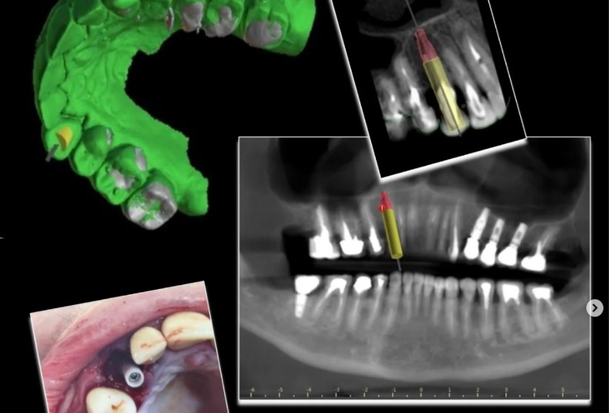 Planejamento Digital Odontológico
